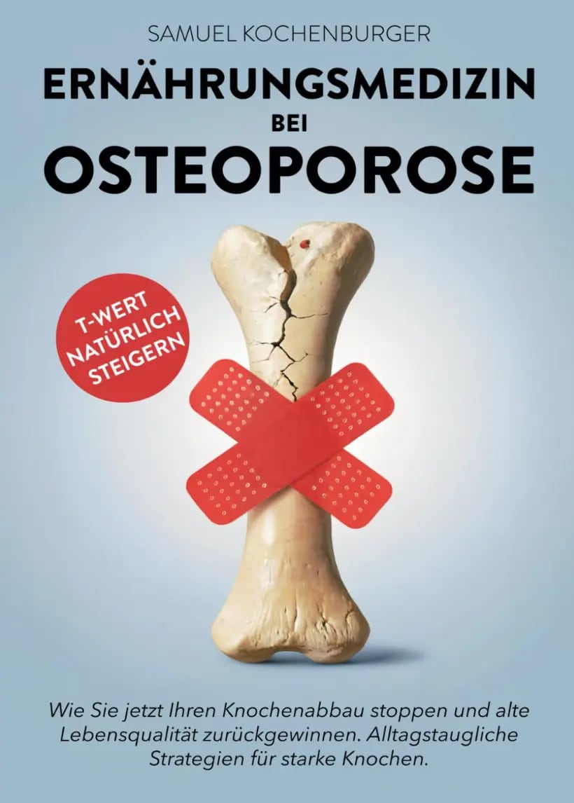 Buchcover: Ernährungsmedizin bei Osteoporose
